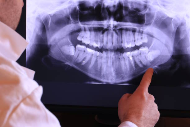Best Broken or Chipped Tooth Repair in Magnolia, MS