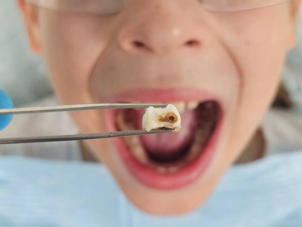 Best Emergency Cosmetic Dentistry (e.g., broken veneers) in Magnolia, MS